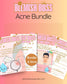 🌟 Blemish Boss Acne Guide Bundle {$88 Value}