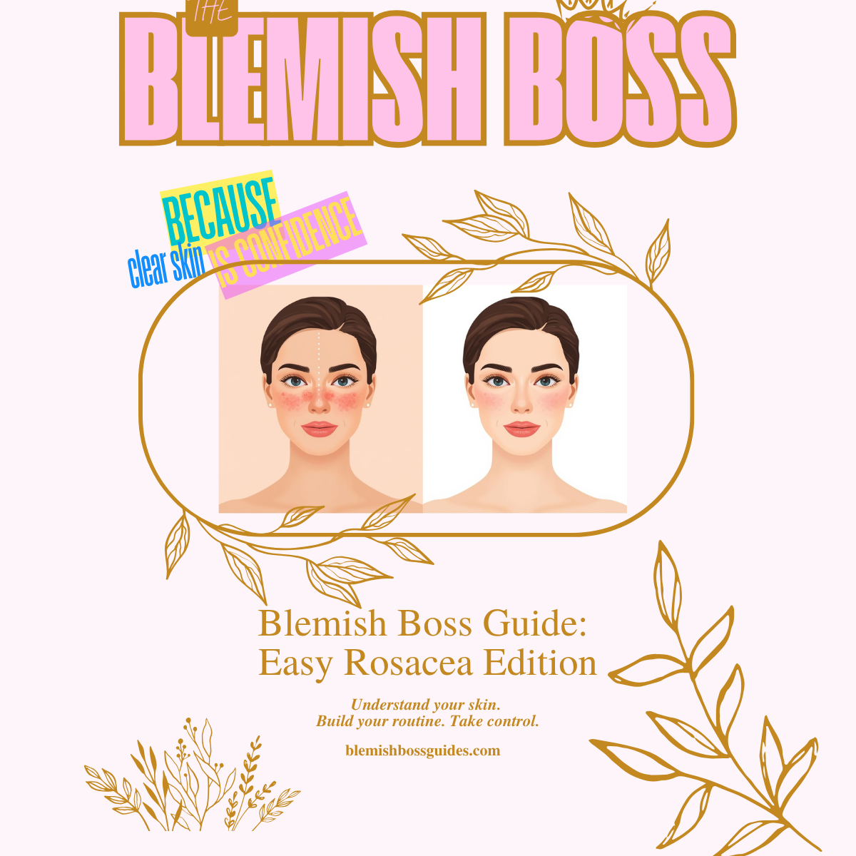 🌟 Blemish Boss Rosacea Bundle {$71 Value}